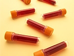 Donare il sangue: la nostra inchiesta